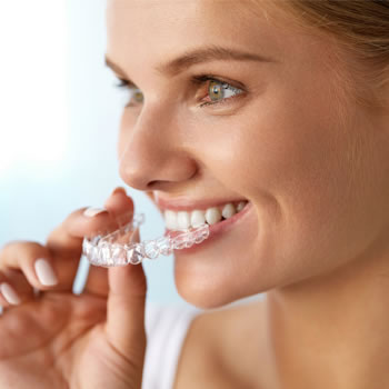 clear aligners